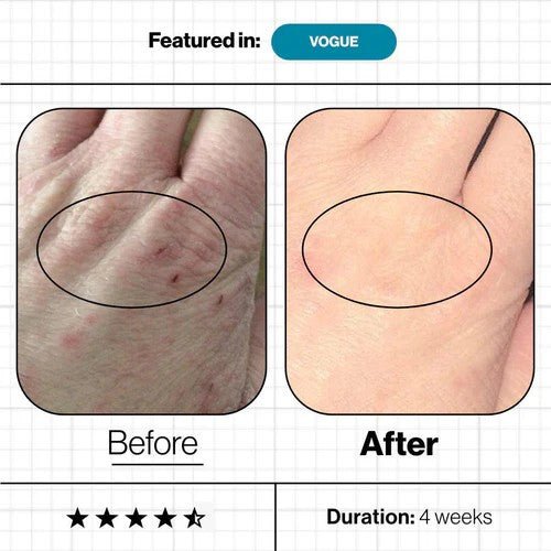 現貨英國Advanced Nutrition Programme 水潤肌Omegas維A療程(60粒)買三送益生菌10日裝超優惠Advanced Nutrition ProgrammeBeauty decoder 醫美護膚品專門店