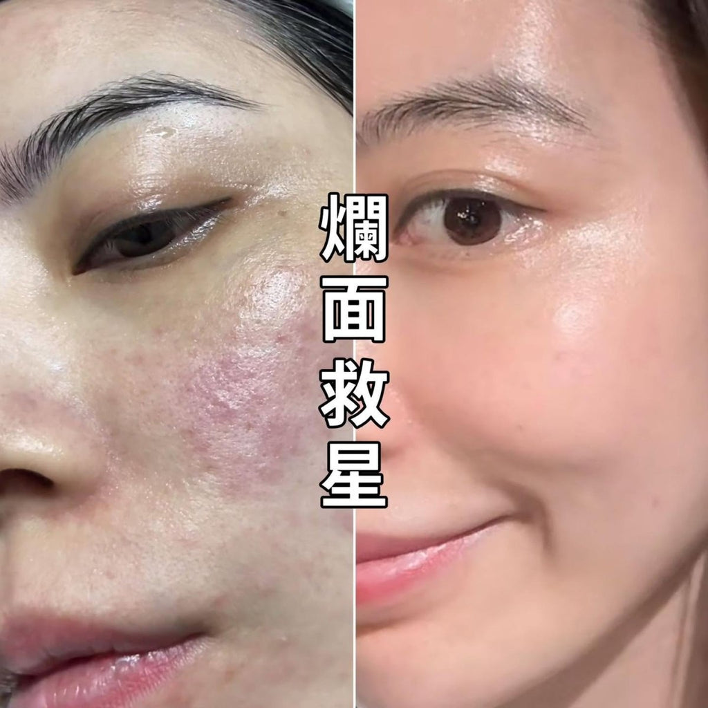 現貨韓國CepoLAB 50%生物基因保濕霜80g (臭霜) 買一送一, 共2件 (送15ml)超優惠CepoLABBeauty decoder 醫美護膚品專門店