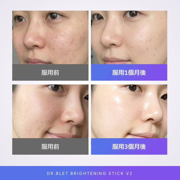 【現貨】韓國DR. BLET 谷胱甘肽美白水光白玉棒V2 (2g x14包)最抵價Beauty decoder 醫美護膚品專門店8809051852208