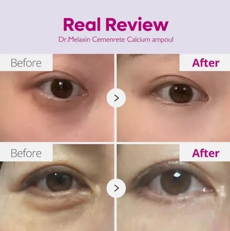 韓國Dr. Melaxin 眼袋隱形霜 10ml眼霜Dr. MelaxinBeauty decoder 醫美護膚品專門店
