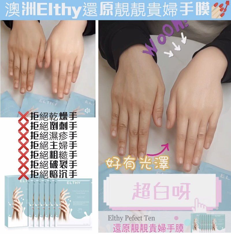 現貨澳洲Elthy 高效保濕貴婦手膜(1盒6對)超優惠ELTHYBeauty decoder 醫美護膚品專門店