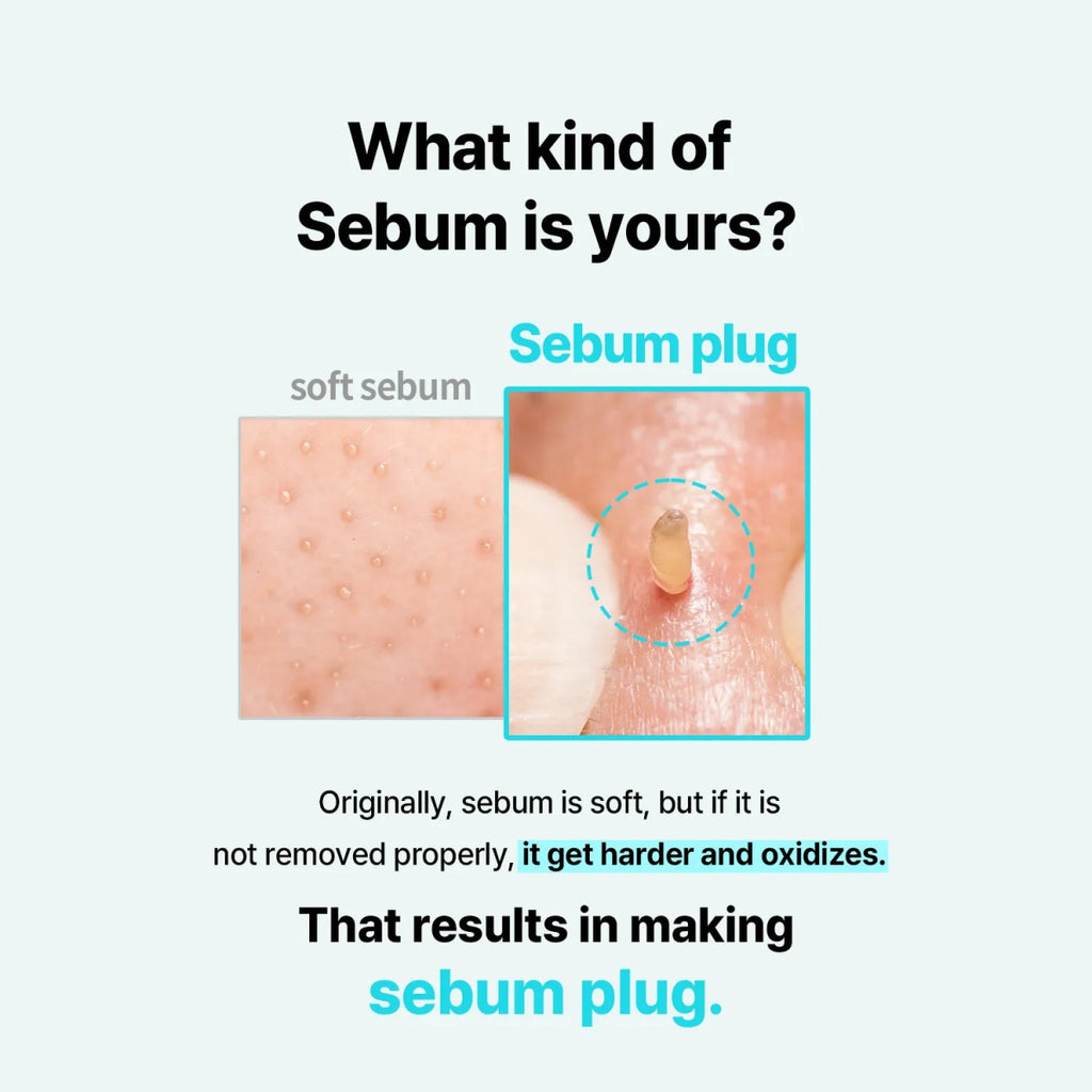 現貨韓國ilso 黑頭粉刺導出液150ml (+送濕敷棉40片) 新包裝超優惠ilsoBeauty decoder 醫美護膚品專門店