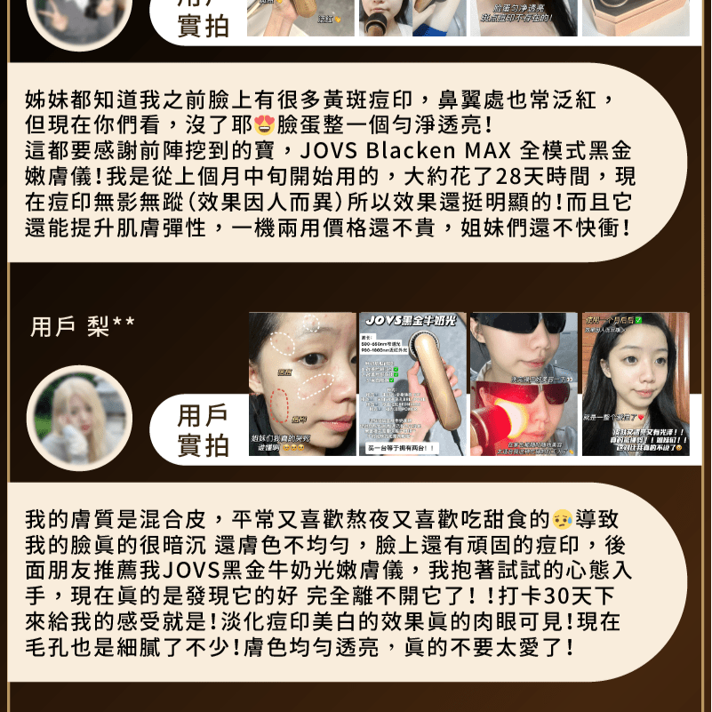 現貨[現貨]JOVS Blacken Max 黑鉑金牛奶光嫩膚儀 (1年保養)超優惠JOVSBeauty decoder 醫美護膚品專門店