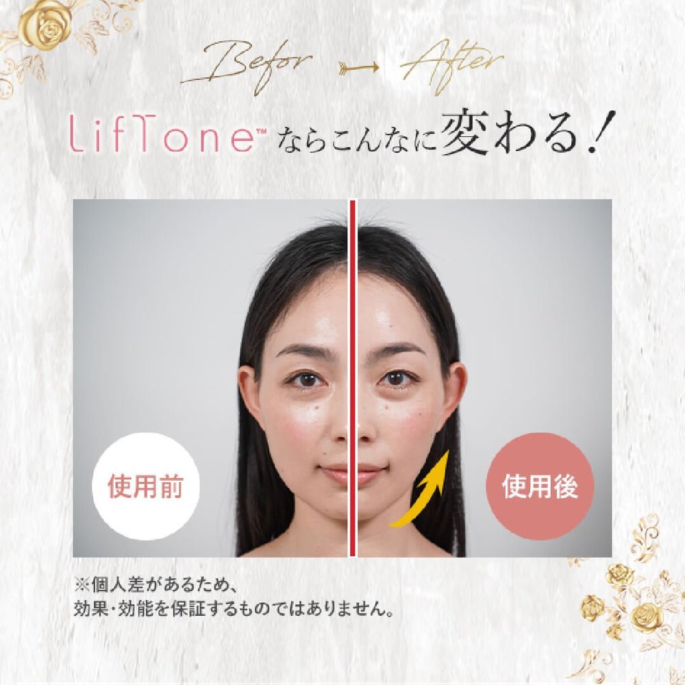 日本Liftone 祛紋寶全方位護理美容儀（一年保養）美容儀LiftoneBeauty decoder 醫美護膚品專門店