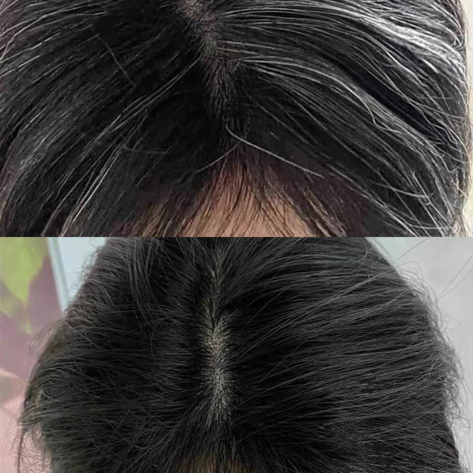 現貨Magic Lab 生髮防白套裝(白變黑洗頭水+生髮精華)超優惠Magic LabBeauty decoder 醫美護膚品專門店