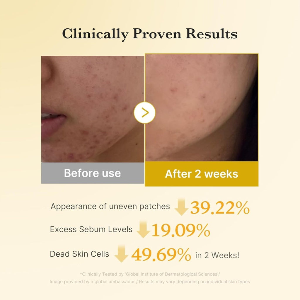 現貨韓國Medicube 曲酸薑黃亮白鎮靜去角質棉片(70片)超優惠MEDICUBEBeauty decoder 醫美護膚品專門店