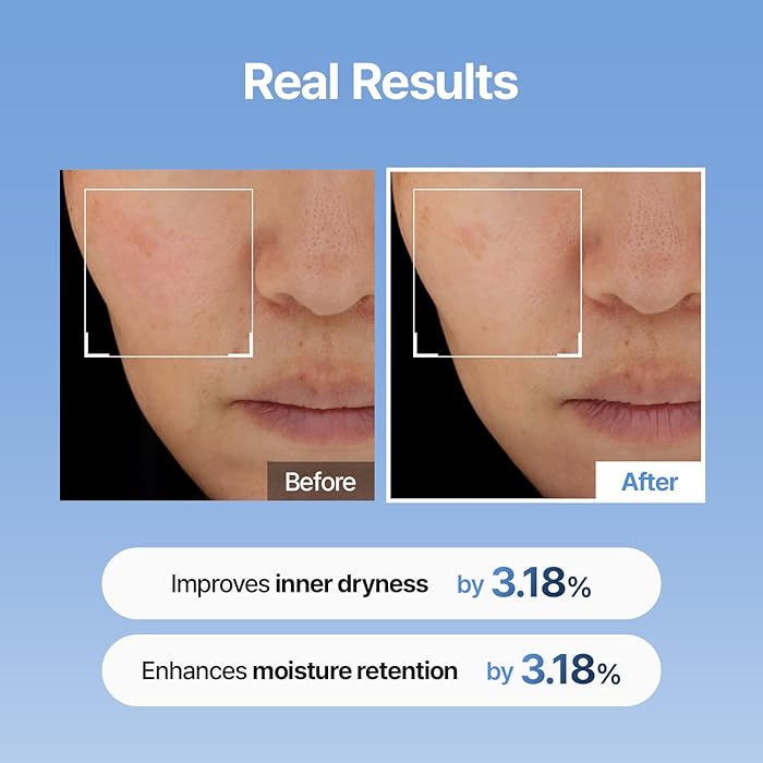 現貨韓國MEDITHERAPY 333玻尿酸保濕精華150ml超優惠MEDITHERAPYBeauty decoder 醫美護膚品專門店8809606777260