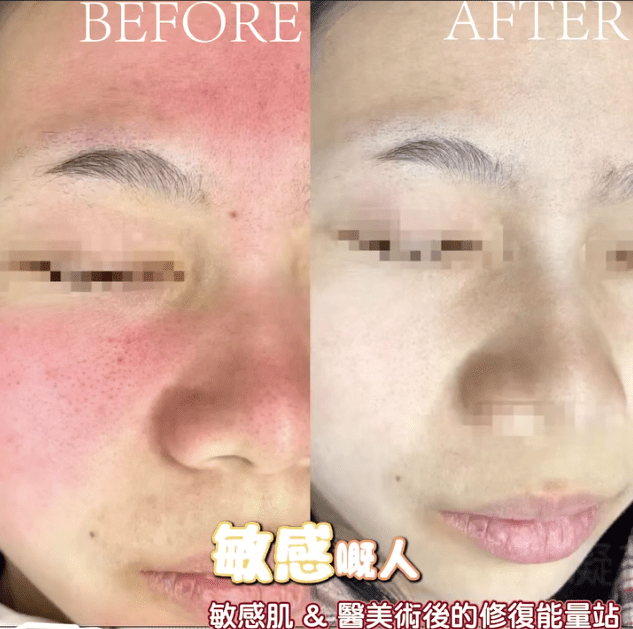 現貨韓國NEU - F Pro Spa Recovery 修復凝膠面膜300g美容院版超優惠Neuface ProBeauty decoder 醫美護膚品專門店