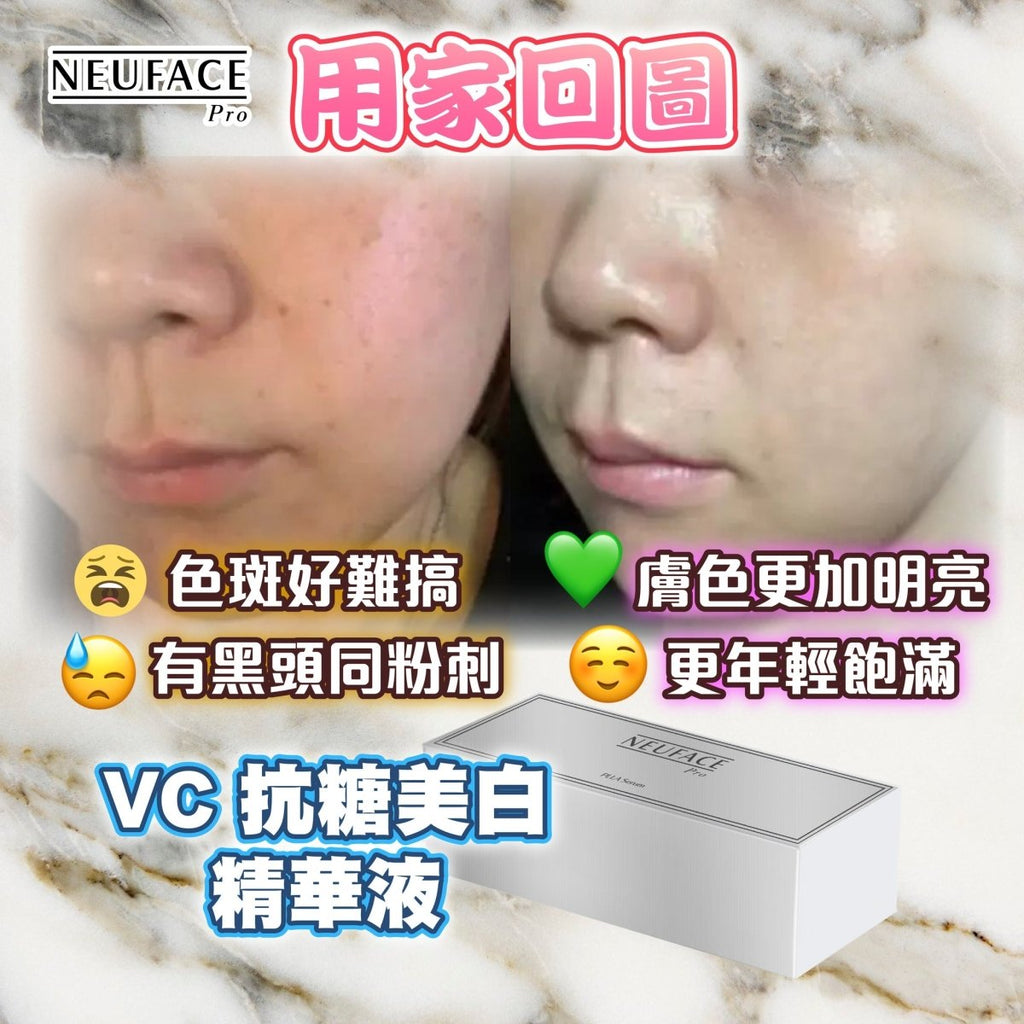 韓國Neuface Pro VC PLLA Serum 抗糖美白高光液(1盒14支)精華素Neuface ProBeauty decoder 醫美護膚品專門店