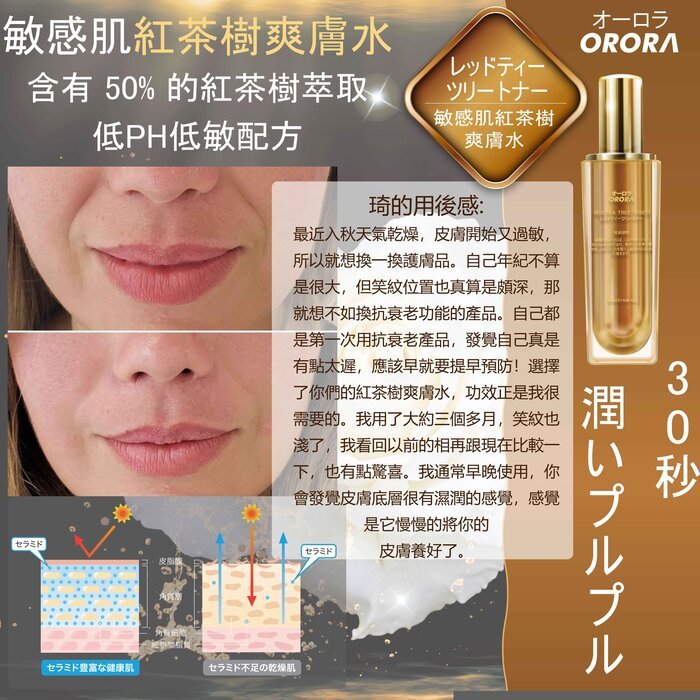 現貨日本ORORA 敏感肌紅茶樹去皺保濕爽膚水120ml超優惠ORORABeauty decoder 醫美護膚品專門店
