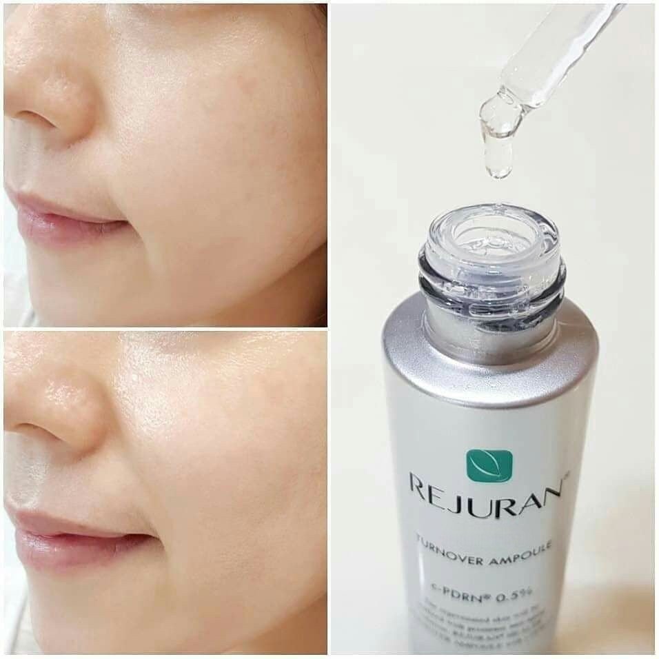 現貨韓國Rejuran 麗珠蘭銀裝水光1+1 (銀裝安瓶+銀裝升級版面霜)超優惠RejuranBeauty decoder 醫美護膚品專門店