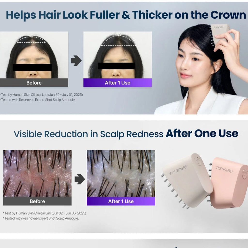 現貨韓國Resnovae 頭皮護理爆髮機(少女梳)超優惠ResnovaeBeauty decoder 醫美護膚品專門店