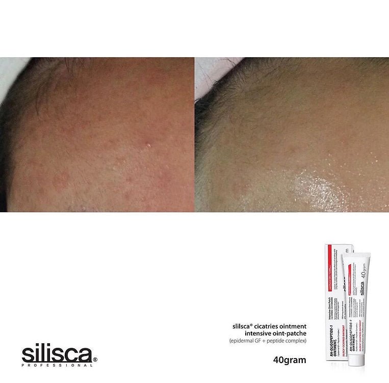 現貨韓國Silisca Cicatries Ointment 強效再生修復王乳霜40g(送細支10g)超優惠SiliscaBeauty decoder 醫美護膚品專門店