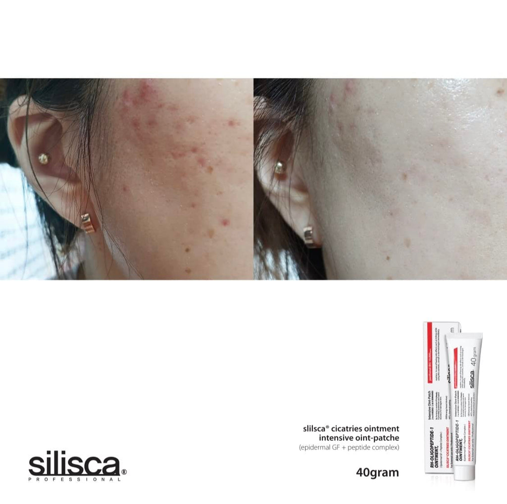 現貨韓國Silisca Cicatries Ointment 強效再生修復王乳霜40g(送細支10g)超優惠SiliscaBeauty decoder 醫美護膚品專門店