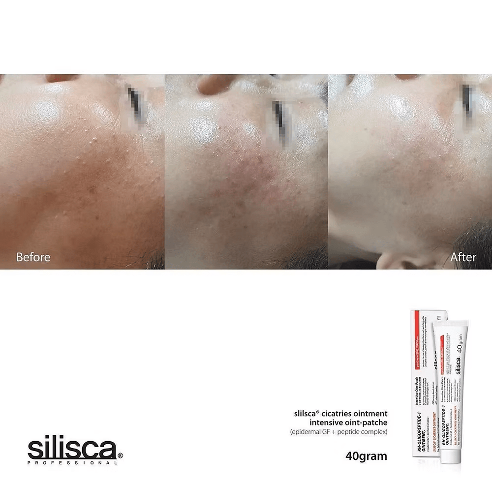 現貨韓國Silisca Cicatries Ointment 強效再生修復王乳霜40g(送細支10g)超優惠SiliscaBeauty decoder 醫美護膚品專門店