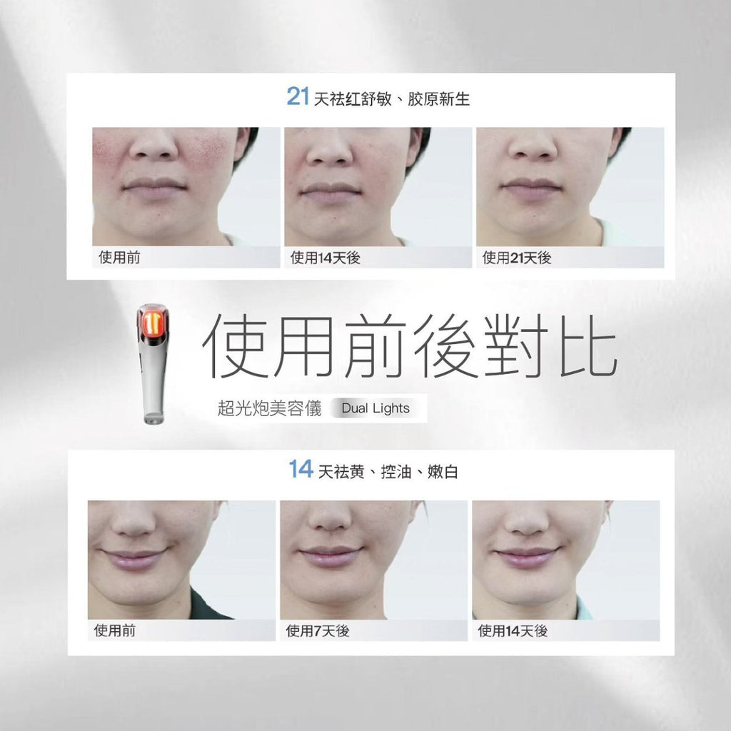 [現貨]Ulike 超光砲美容儀 牛奶光子嫩膚淡斑淡痘美白《行貨2年保養》美容儀UlikeBeauty decoder 醫美護膚品專門店