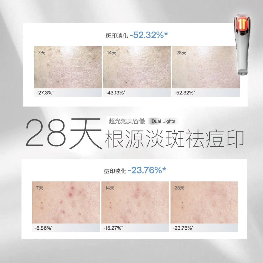 [現貨]Ulike 超光砲美容儀 牛奶光子嫩膚淡斑淡痘美白《行貨2年保養》美容儀UlikeBeauty decoder 醫美護膚品專門店
