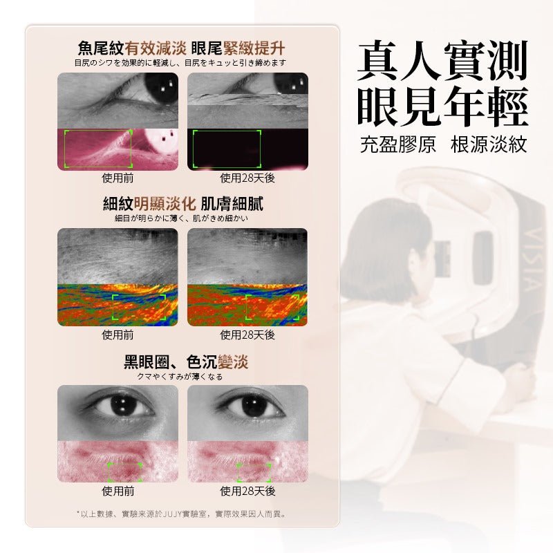 日本JUJY 第3代全效多極射頻美眼儀PRO (送射頻眼專用GEL） 日本JUJY 第3代全效多極射頻美眼儀PRO (送射頻眼專用GEL） 