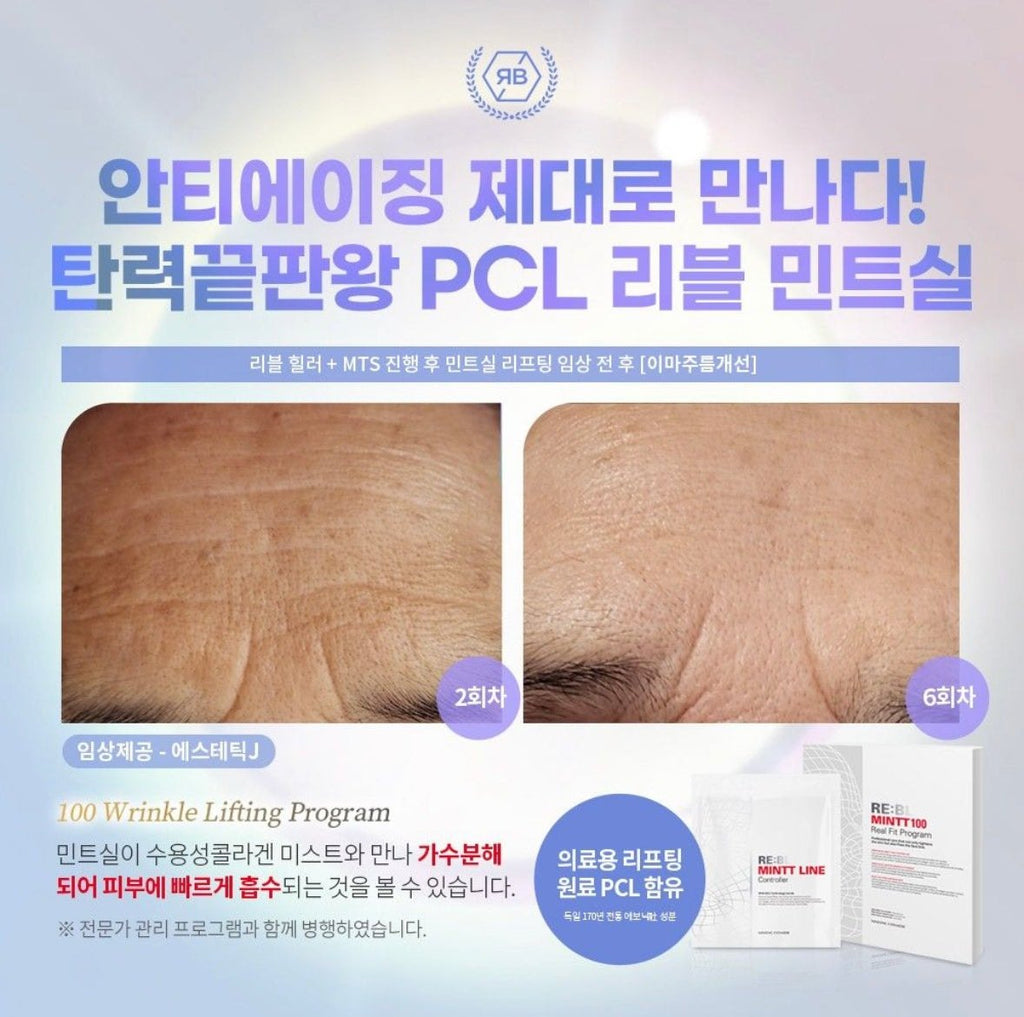 韓國 RE:BL MINTT 100 Real Fit Program 無針埋線面膜 （3次套裝）面膜MINTTBeauty decoder 醫美護膚品專門店